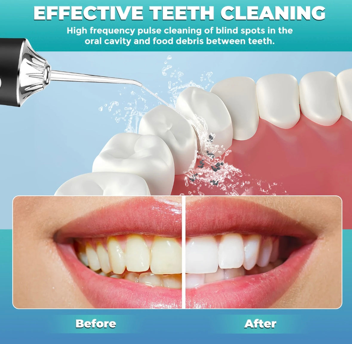 AquaSmile™ Portable Oral Irrigator