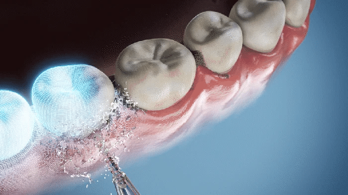 AquaSmile™ Portable Oral Irrigator